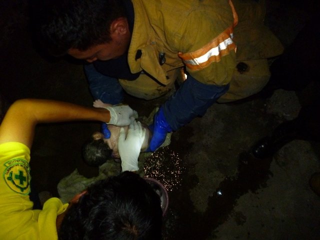 fosa1