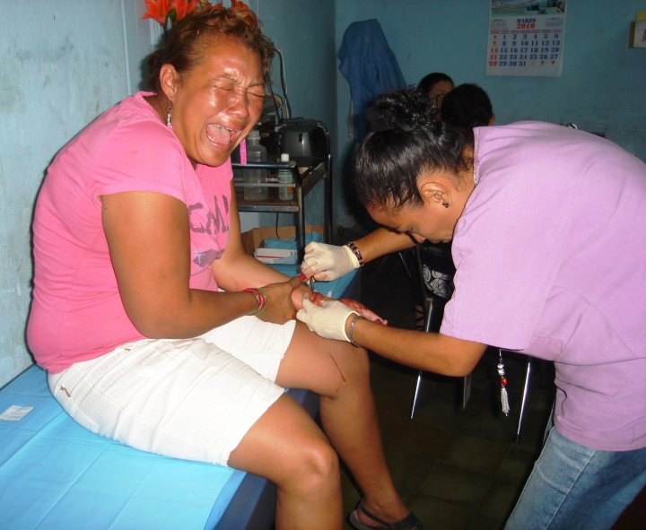 suture1